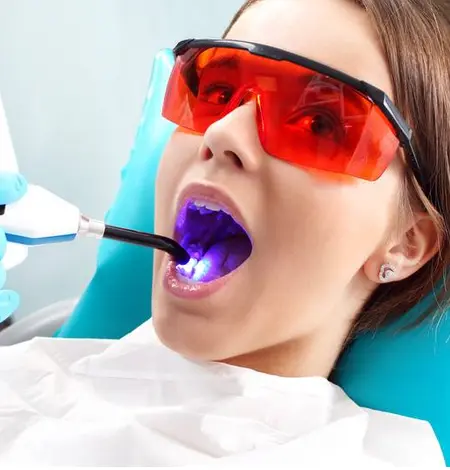 Laser odontoiatrico
